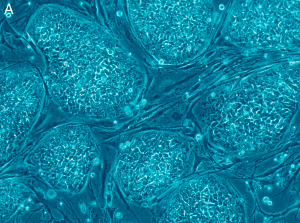 Human Embryonic Stem Cell Image from Follow the Money – The Politics of Embryonic Stem Cell Research. Russo E, PLoS Biology Vol. 3/7/2005, e234. doi:10.1371/journal.pbio.0030234 