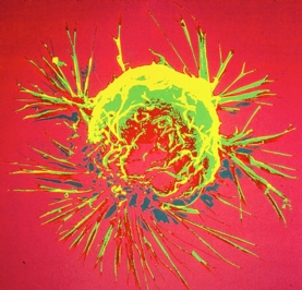 cancer cell