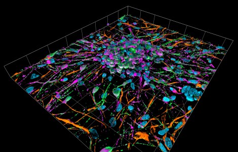 rat_primary_cortical_neuron_culture_3d_reconstruction_30614936992
